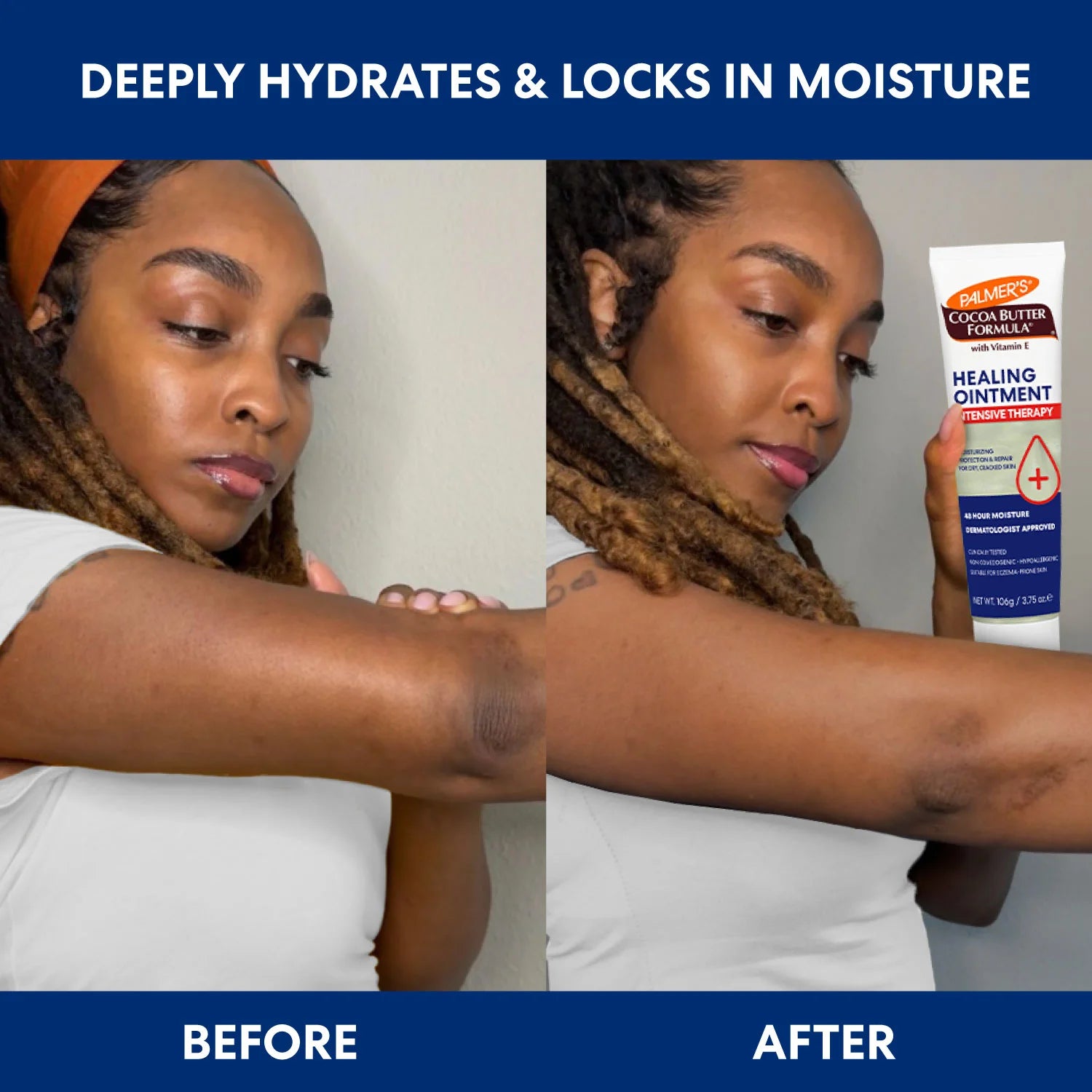 Intensive Therapy Healing Ointment - Image 4